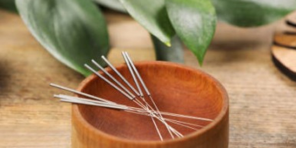 What are the benefits of acupuncture in the Okanagan?