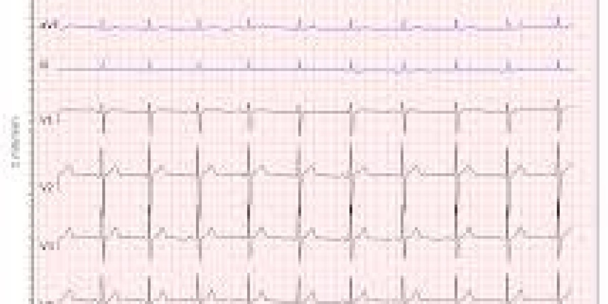 ECG Online Course: Learn to Interpret ECGs Anytime, Anywhere