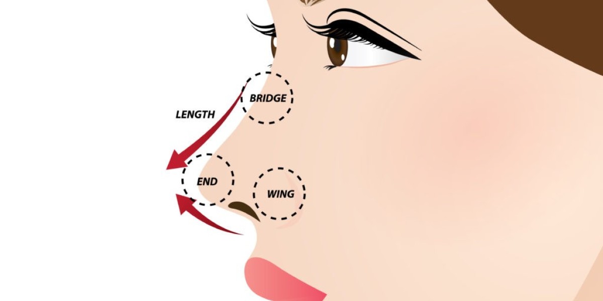 Cartilage Rhinoplasty