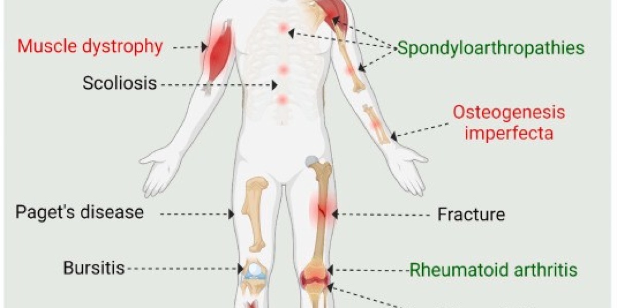 Benefits of Pain O Soma 500 mg: A Comprehensive Guide