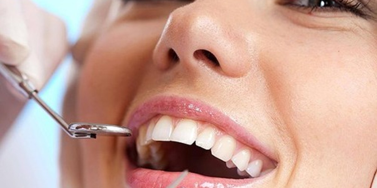 Transform Your Smile: The Comprehensive Guide to Dental Implants in Tampa