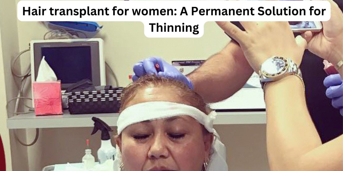 Hair transplant for women: A Permanent Solution for Thinning